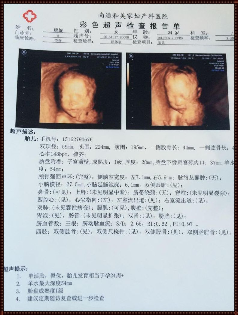 28周羊水比24周羊水少，这正常吗？