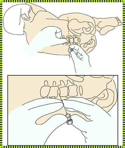 小孩抽搐有必要做腰穿吗？