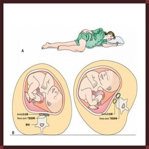 胎儿喜欢孕妇站着还是躺着：一次深入的探讨
