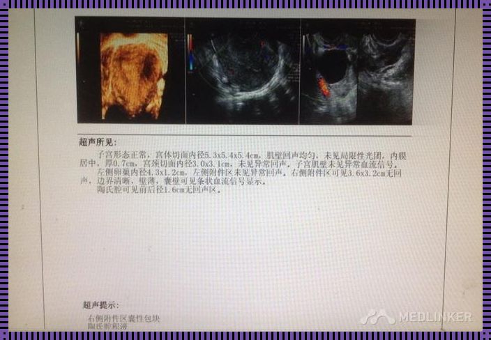 宫外孕怀孕多久能检查出来？揭秘宫外孕早期诊断